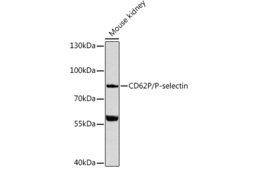 Western Blot - Anti-P-Selectin Antibody (A91439) - Antibodies.com
