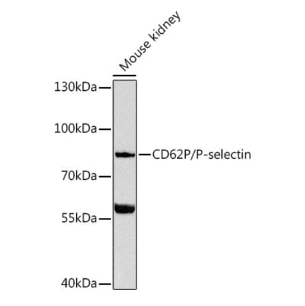 Western Blot - Anti-P-Selectin Antibody (A91439) - Antibodies.com