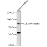Western Blot - Anti-P-Selectin Antibody (A91439) - Antibodies.com