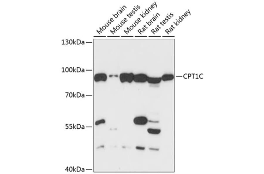Western Blot - Anti-Cpt1c/CPT1-B Antibody (A91440) - Antibodies.com