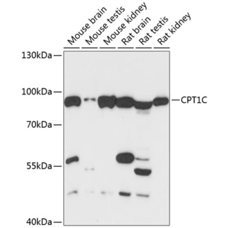 Western Blot - Anti-Cpt1c/CPT1-B Antibody (A91440) - Antibodies.com