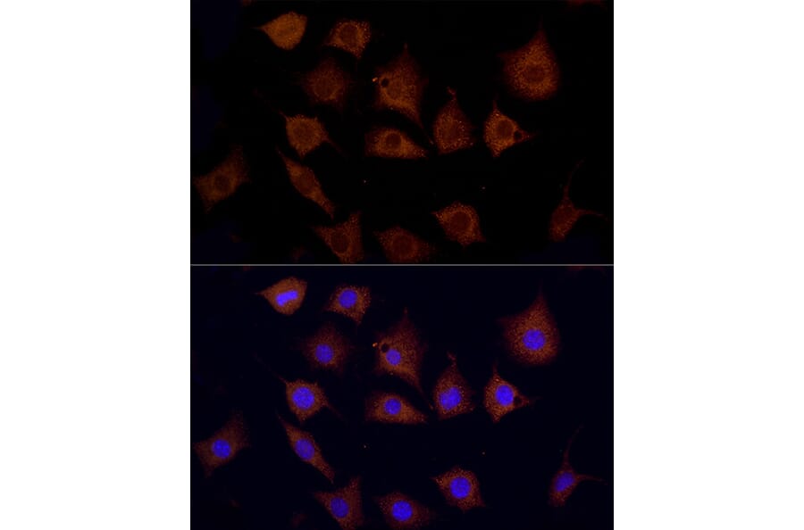 Immunofluorescence - Anti-Cpt1c/CPT1-B Antibody (A91440) - Antibodies.com