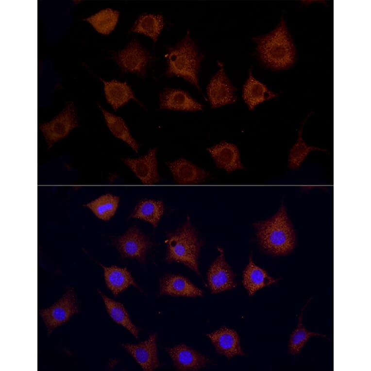 Immunofluorescence - Anti-Cpt1c/CPT1-B Antibody (A91440) - Antibodies.com