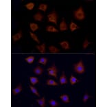 Immunofluorescence - Anti-Cpt1c/CPT1-B Antibody (A91440) - Antibodies.com