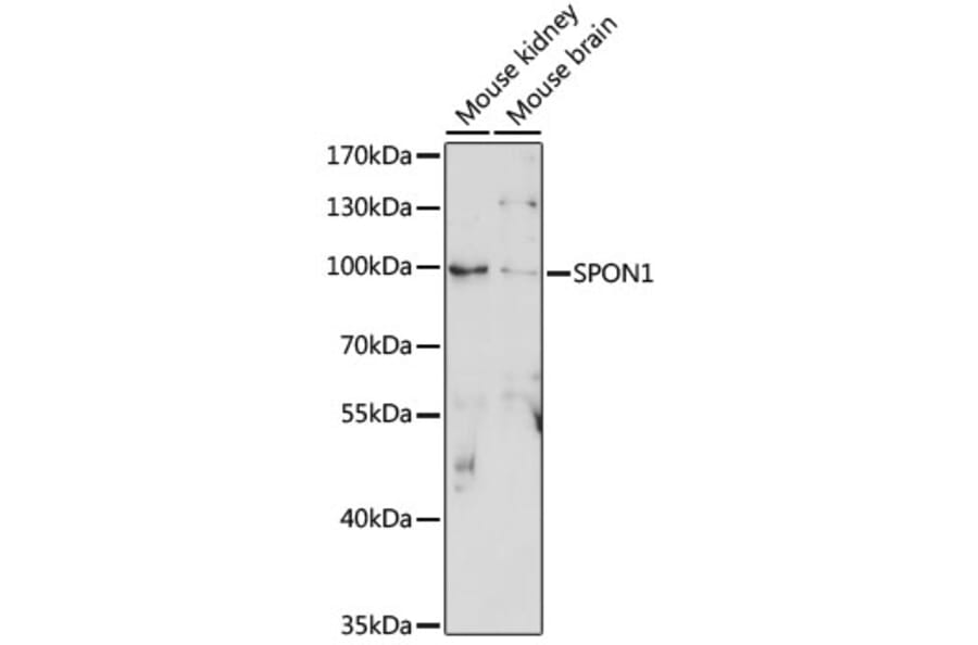 Anti-F-spondin Antibody (A91441) | Antibodies.com