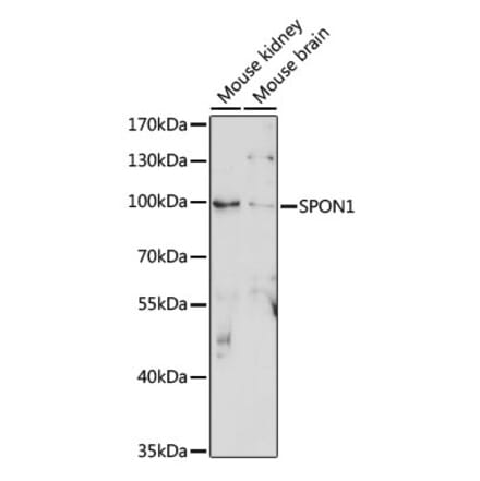 Western Blot - Anti-F-spondin Antibody (A91441) - Antibodies.com