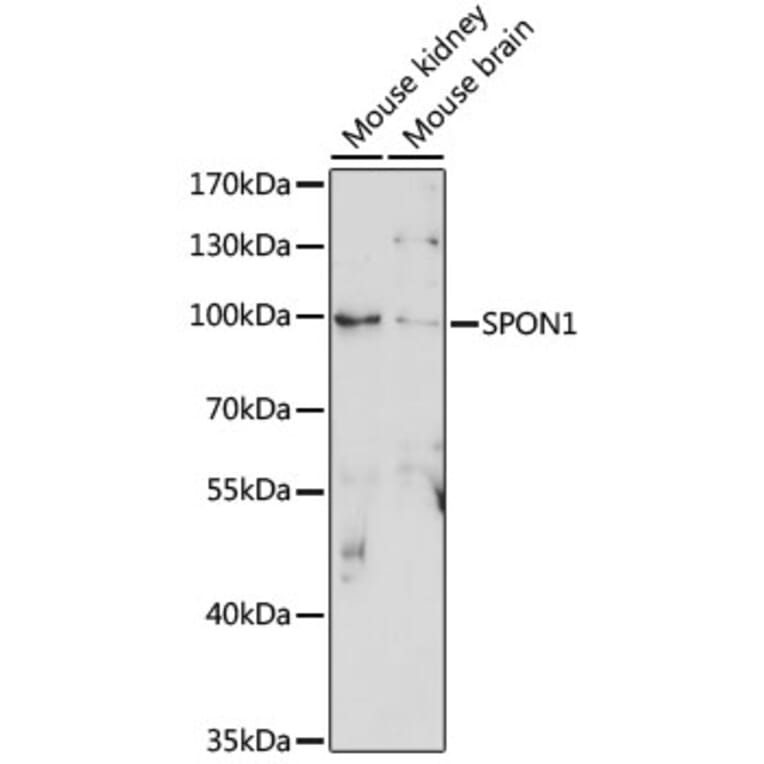Western Blot - Anti-F-spondin Antibody (A91441) - Antibodies.com