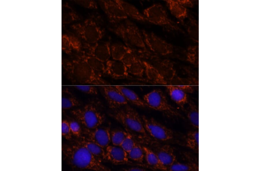 Immunofluorescence - Anti-PI4 kinase beta/PI4KB Antibody (A91442) - Antibodies.com