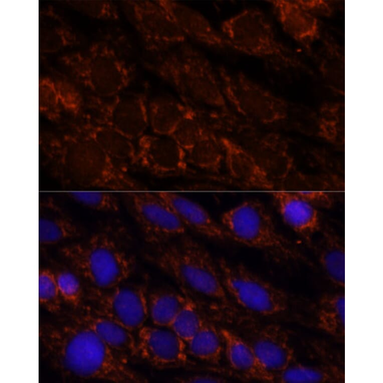 Immunofluorescence - Anti-PI4 kinase beta/PI4KB Antibody (A91442) - Antibodies.com