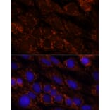 Immunofluorescence - Anti-PI4 kinase beta/PI4KB Antibody (A91442) - Antibodies.com