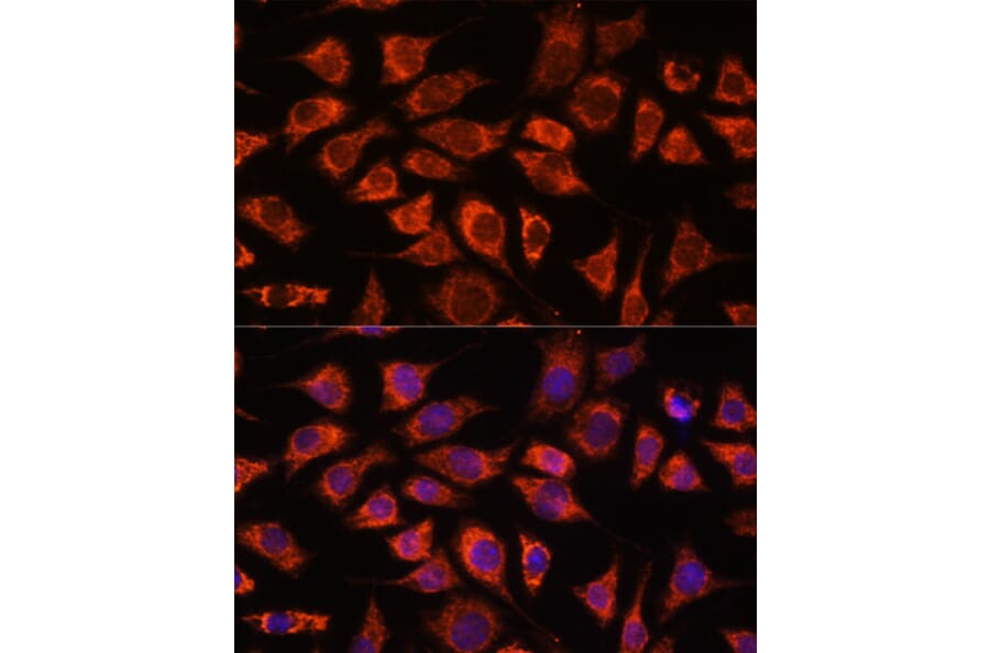 Immunofluorescence - Anti-PI4 kinase beta/PI4KB Antibody (A91442) - Antibodies.com