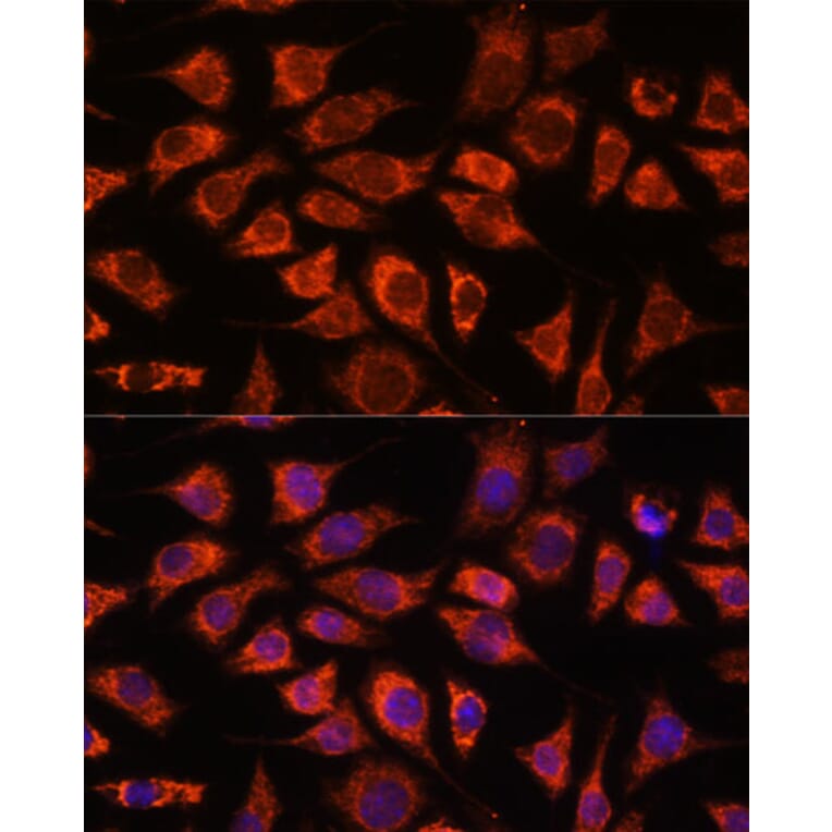 Immunofluorescence - Anti-PI4 kinase beta/PI4KB Antibody (A91442) - Antibodies.com