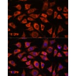Immunofluorescence - Anti-PI4 kinase beta/PI4KB Antibody (A91442) - Antibodies.com