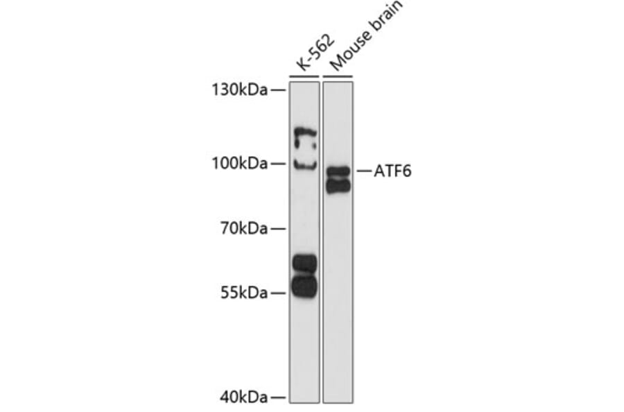 Western Blot - Anti-ATF6 Antibody (A91443) - Antibodies.com