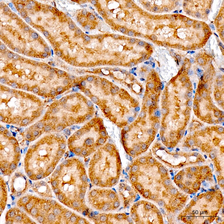 Immunohistochemistry - Anti-ATF6 Antibody (A91443) - Antibodies.com