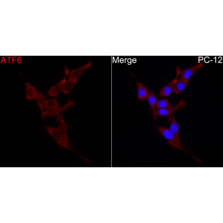 Immunofluorescence - Anti-ATF6 Antibody (A91443) - Antibodies.com