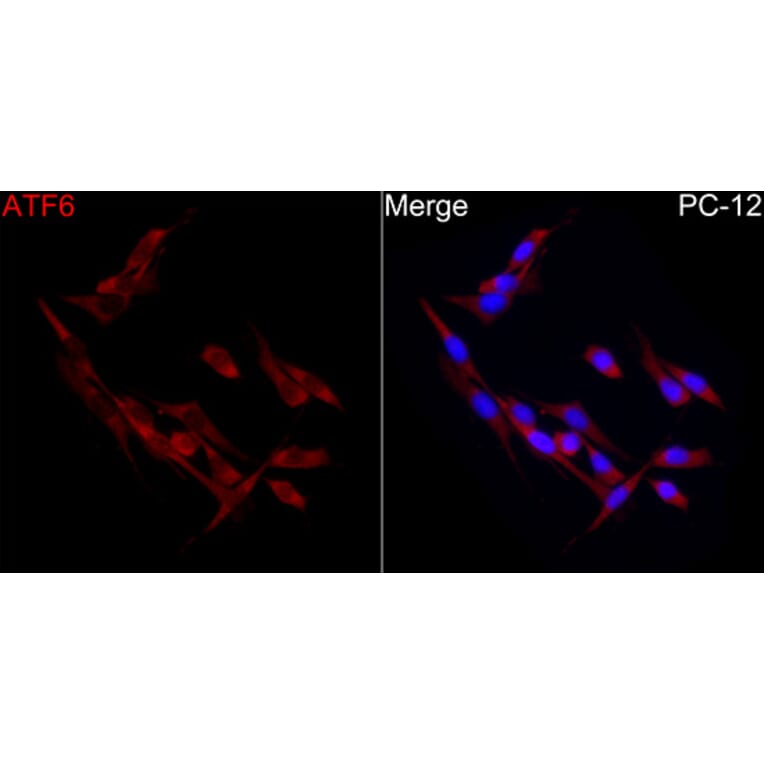 Immunofluorescence - Anti-ATF6 Antibody (A91443) - Antibodies.com