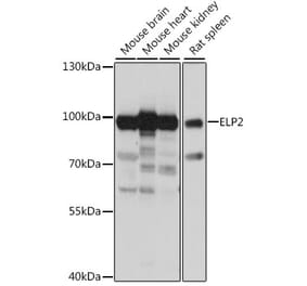 Western Blot - Anti-ELP2 Antibody (A91444) - Antibodies.com