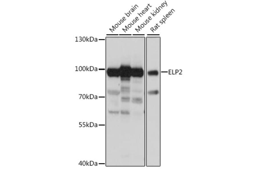 Western Blot - Anti-ELP2 Antibody (A91444) - Antibodies.com