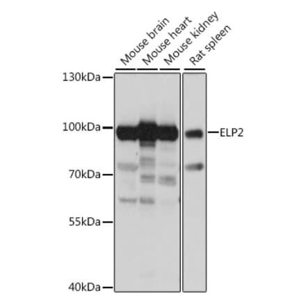 Western Blot - Anti-ELP2 Antibody (A91444) - Antibodies.com
