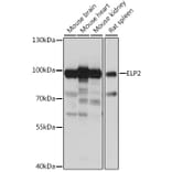 Western Blot - Anti-ELP2 Antibody (A91444) - Antibodies.com
