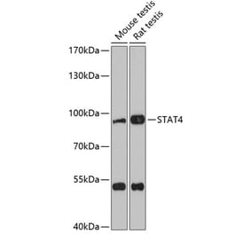 Western Blot - Anti-STAT4 Antibody (A91445) - Antibodies.com