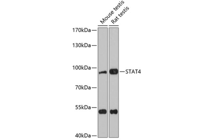 Western Blot - Anti-STAT4 Antibody (A91445) - Antibodies.com