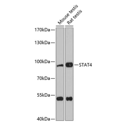 Western Blot - Anti-STAT4 Antibody (A91445) - Antibodies.com