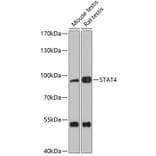 Western Blot - Anti-STAT4 Antibody (A91445) - Antibodies.com