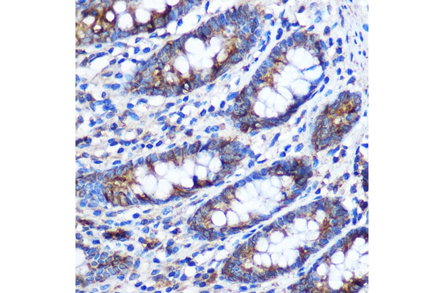 Immunohistochemistry - Anti-STAT4 Antibody (A91445) - Antibodies.com