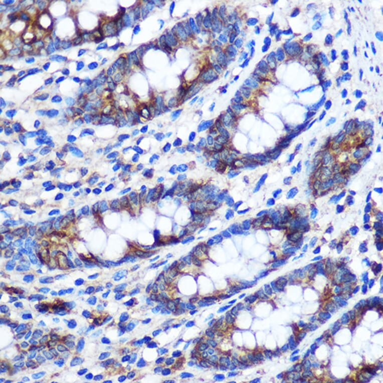 Immunohistochemistry - Anti-STAT4 Antibody (A91445) - Antibodies.com