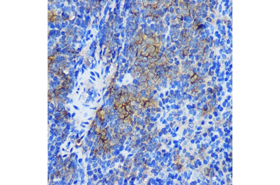 Immunohistochemistry - Anti-STAT4 Antibody (A91445) - Antibodies.com