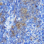 Immunohistochemistry - Anti-STAT4 Antibody (A91445) - Antibodies.com