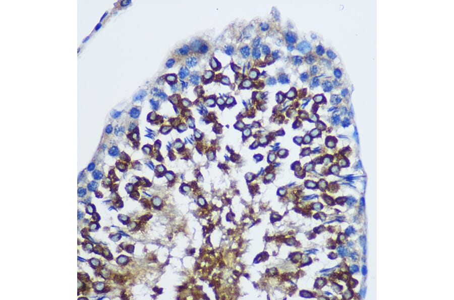 Immunohistochemistry - Anti-STAT4 Antibody (A91445) - Antibodies.com