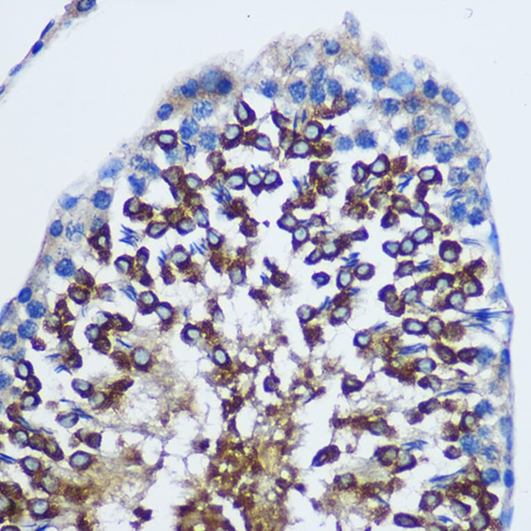 Immunohistochemistry - Anti-STAT4 Antibody (A91445) - Antibodies.com