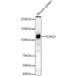 Western Blot - Anti-TCIRG1 Antibody (A91446) - Antibodies.com