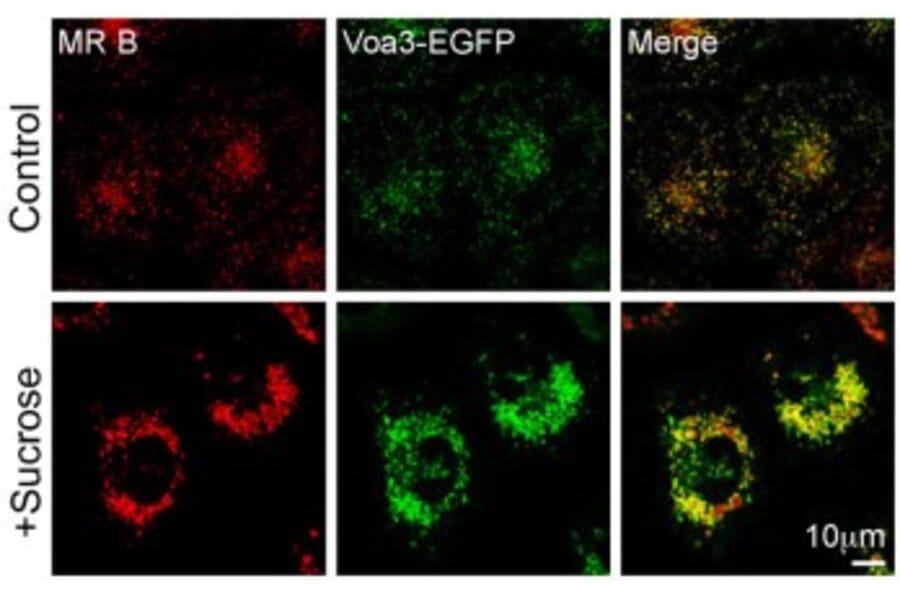 Confocal fluorescence image - Anti-TCIRG1 Antibody - Antibodies.com