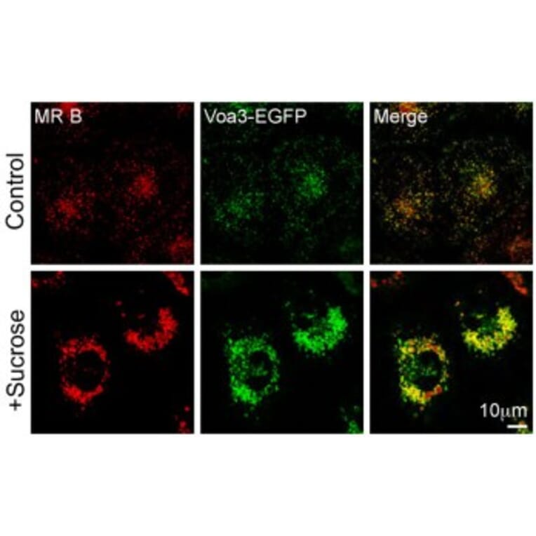 Confocal fluorescence image - Anti-TCIRG1 Antibody - Antibodies.com