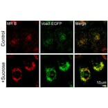 Confocal fluorescence image - Anti-TCIRG1 Antibody - Antibodies.com