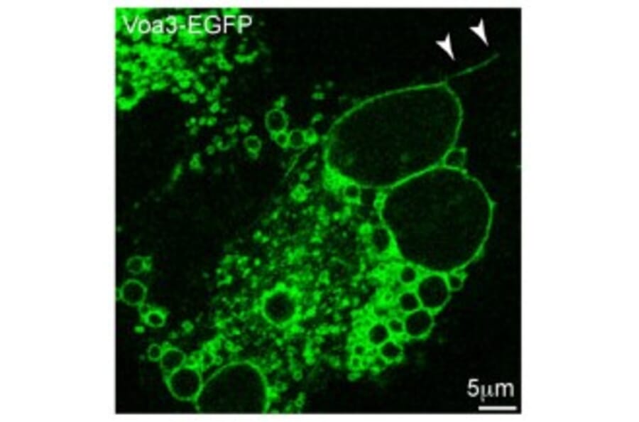 Confocal fluorescence image - Anti-TCIRG1 Antibody - Antibodies.com