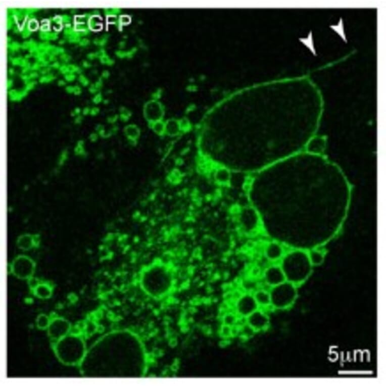 Confocal fluorescence image - Anti-TCIRG1 Antibody - Antibodies.com