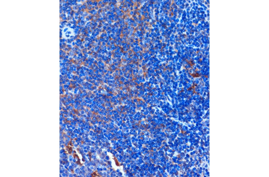 Immunohistochemistry - Anti-TCIRG1 Antibody (A91446) - Antibodies.com