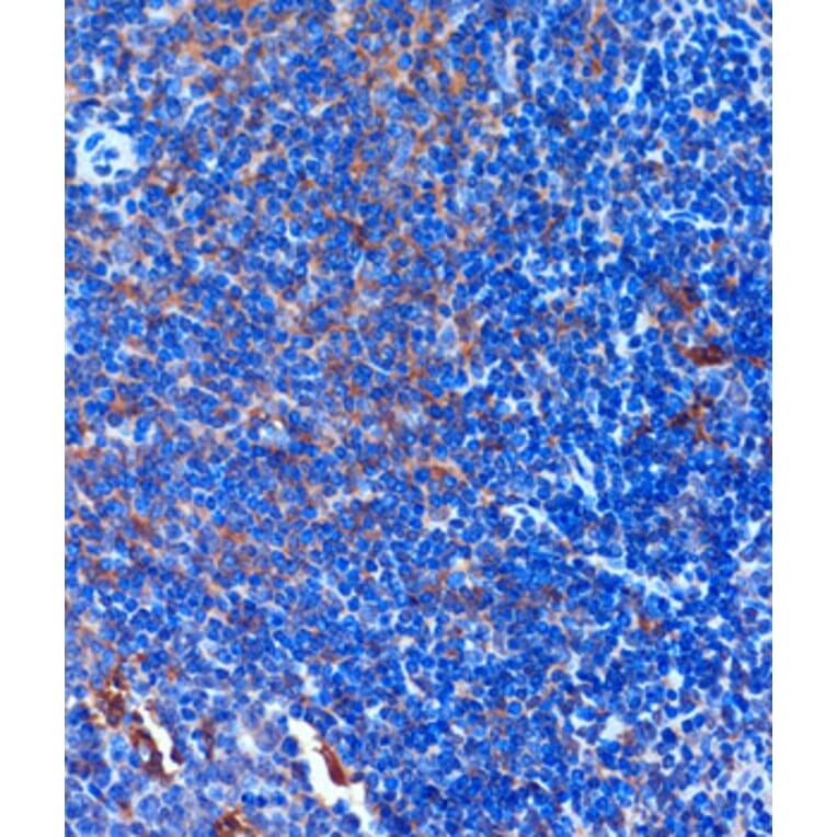 Immunohistochemistry - Anti-TCIRG1 Antibody (A91446) - Antibodies.com