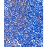 Immunohistochemistry - Anti-TCIRG1 Antibody (A91446) - Antibodies.com