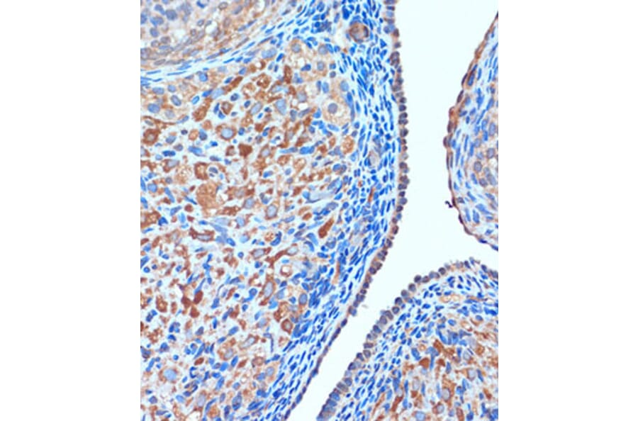 Immunohistochemistry - Anti-TCIRG1 Antibody (A91446) - Antibodies.com