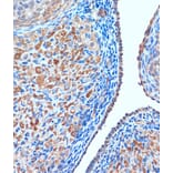 Immunohistochemistry - Anti-TCIRG1 Antibody (A91446) - Antibodies.com