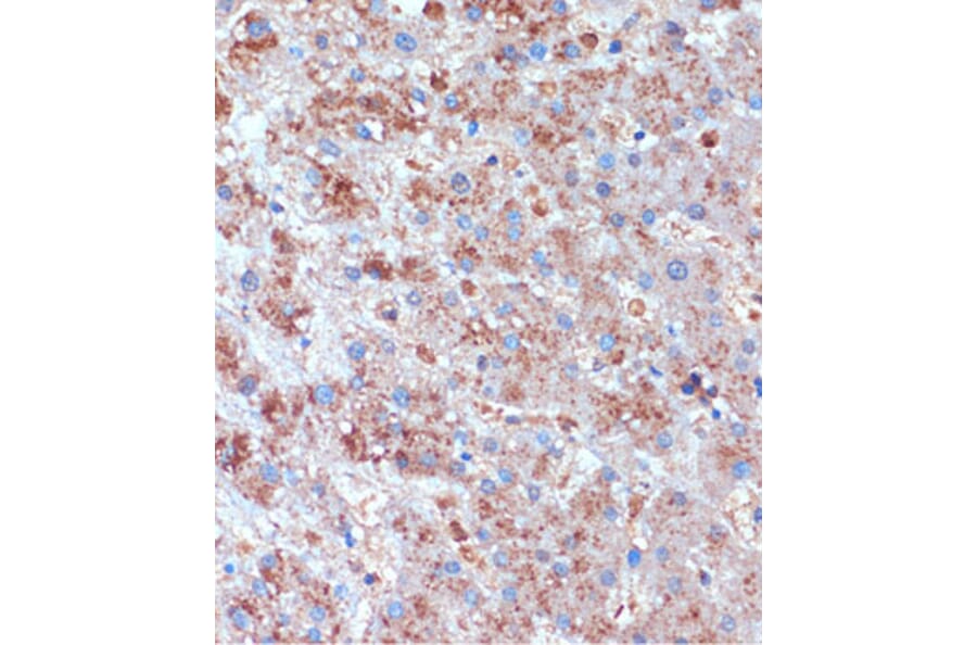 Immunohistochemistry - Anti-TCIRG1 Antibody (A91446) - Antibodies.com