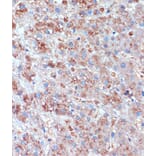 Immunohistochemistry - Anti-TCIRG1 Antibody (A91446) - Antibodies.com