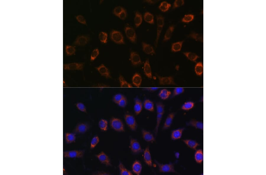 Immunofluorescence - Anti-TCIRG1 Antibody (A91446) - Antibodies.com