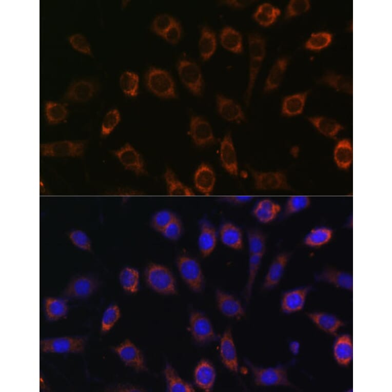 Immunofluorescence - Anti-TCIRG1 Antibody (A91446) - Antibodies.com